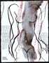 Click to enlarge mixed-technique drawing "Nu-Arbre Nr.35"